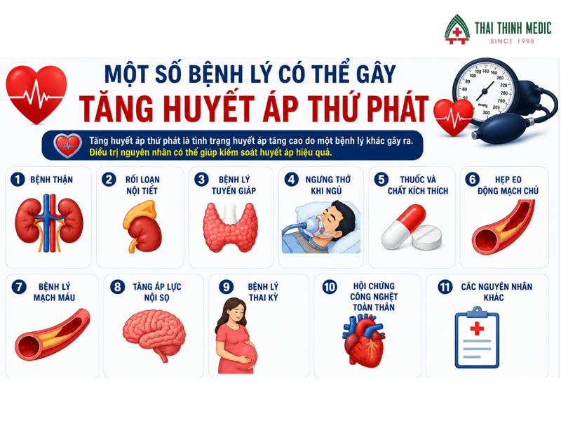 tang-huyet-ap-do-1-co-nguy-hiem-khong-mot-so-benh-ly