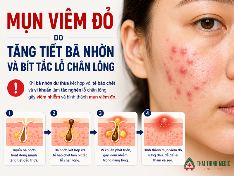 mun-viem-do-do-tang-tiet-ba-nhon