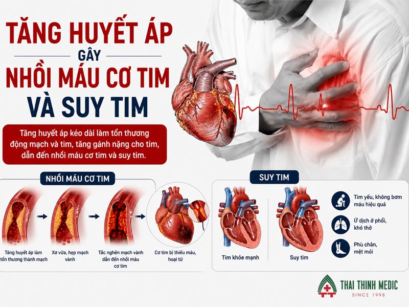 tang-huyet-ap-co-nguy-hiem-khong-nhoi-mau-co-tim