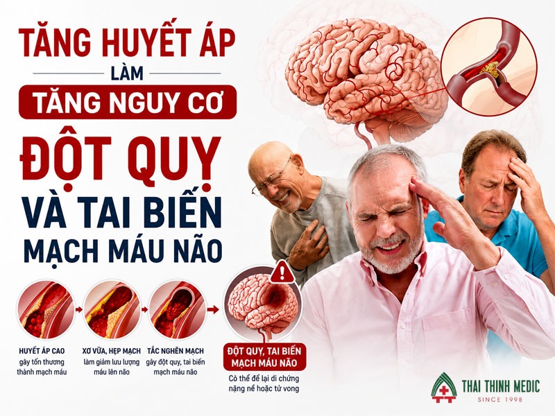 tang-huyet-ap-co-nguy-hiem-khong-dot-quy-tai-bien