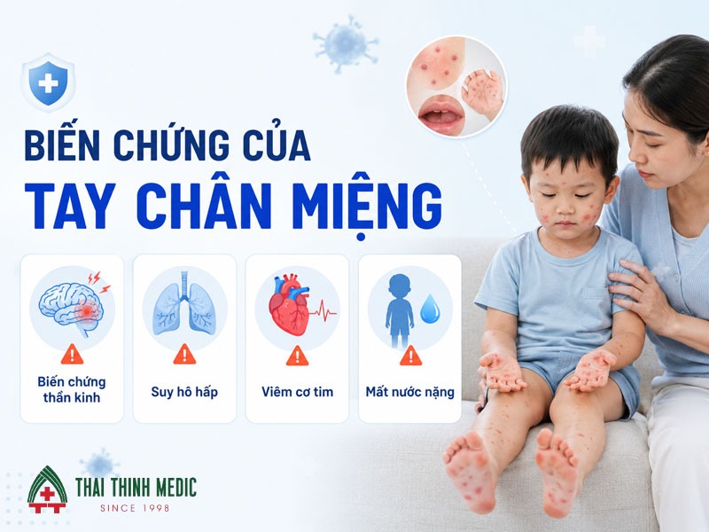 tay-chan-mieng-sot-bao-lau-bien-chung
