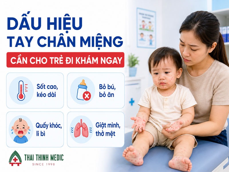 tay-chan-mieng-sot-bao-lau-dau-hieu-cho-tre-di-kham