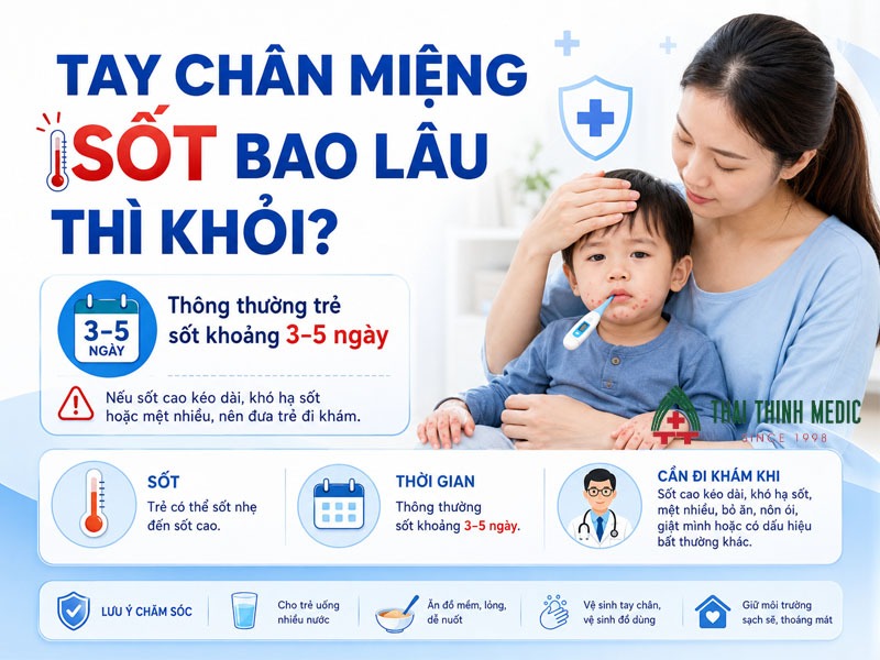 tay-chan-mieng-sot-bao-lau-thi-khoi