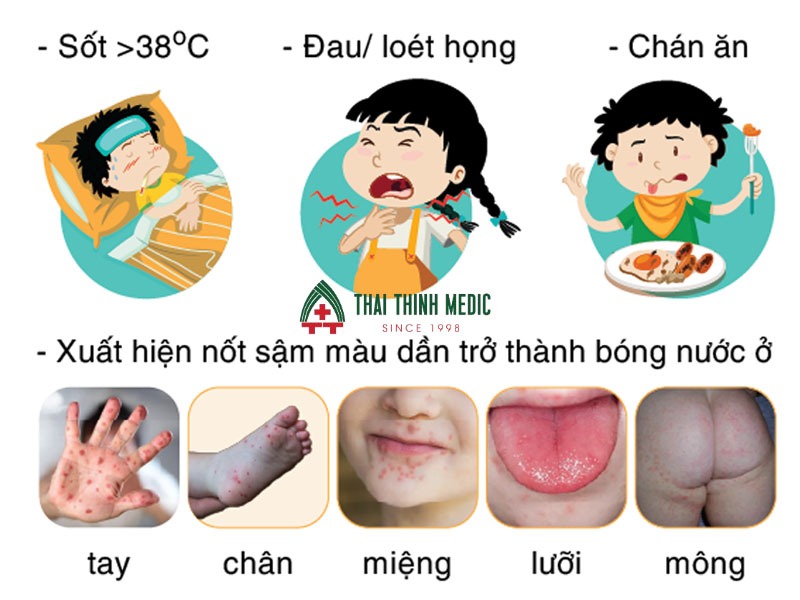 tre-bi-tay-chan-mieng-nen-an-gi-cau-hoi