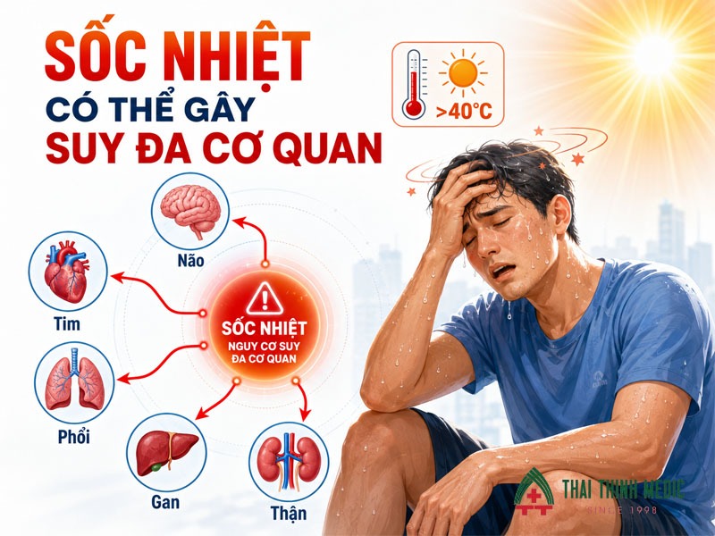 soc-nhiet-gay-suy-da-co-quan