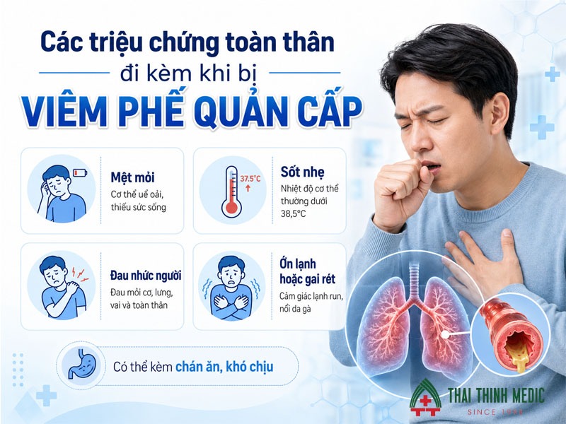 trieu-chung-toan-than-viem-phe-quan-cap