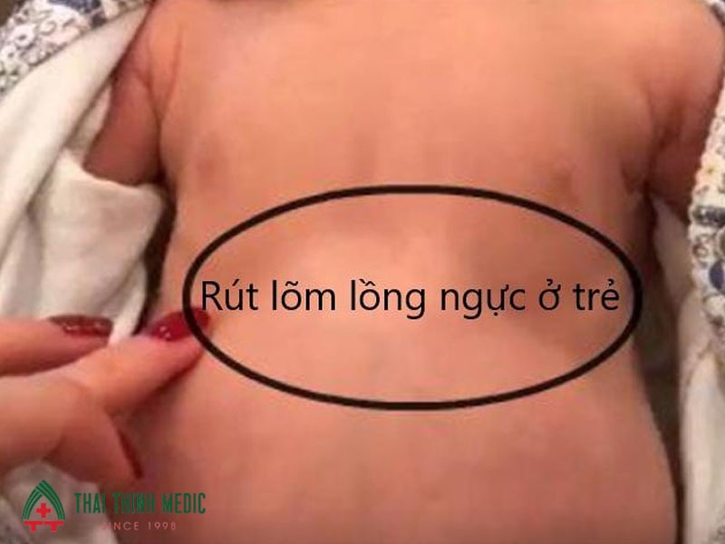 tre-nho-nam-dieu-hoa-bi-ho-lom-nguc