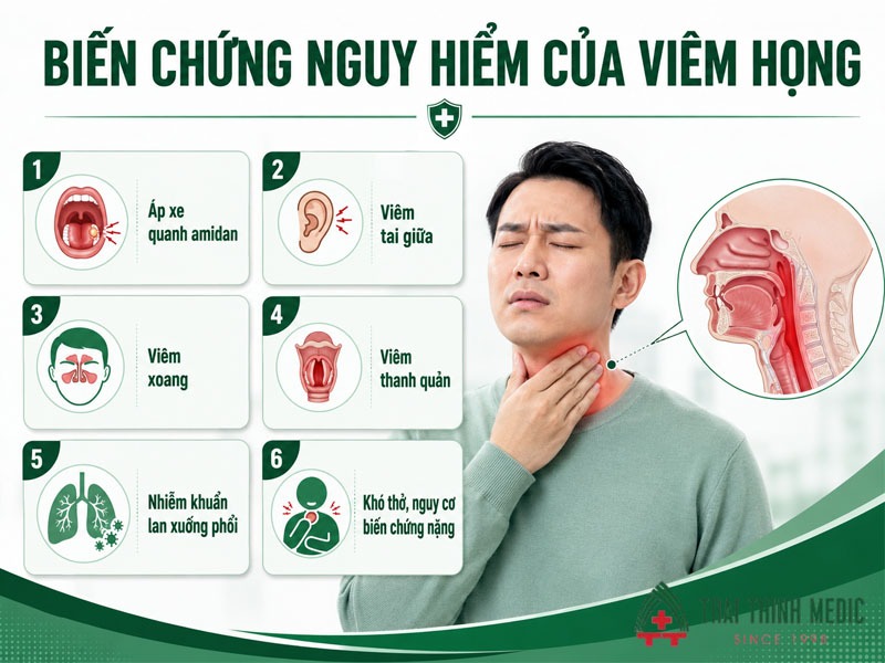 bien-chung-cua-viem-hong