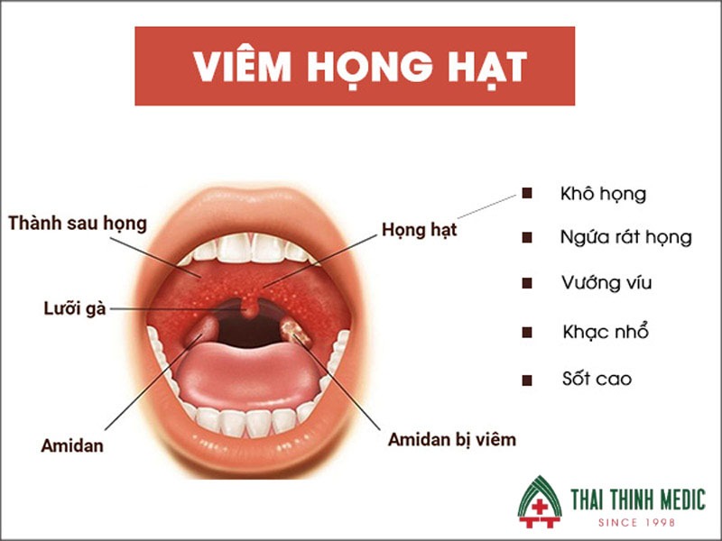 dung-khang-sinh-dieu-tri-viem-hong