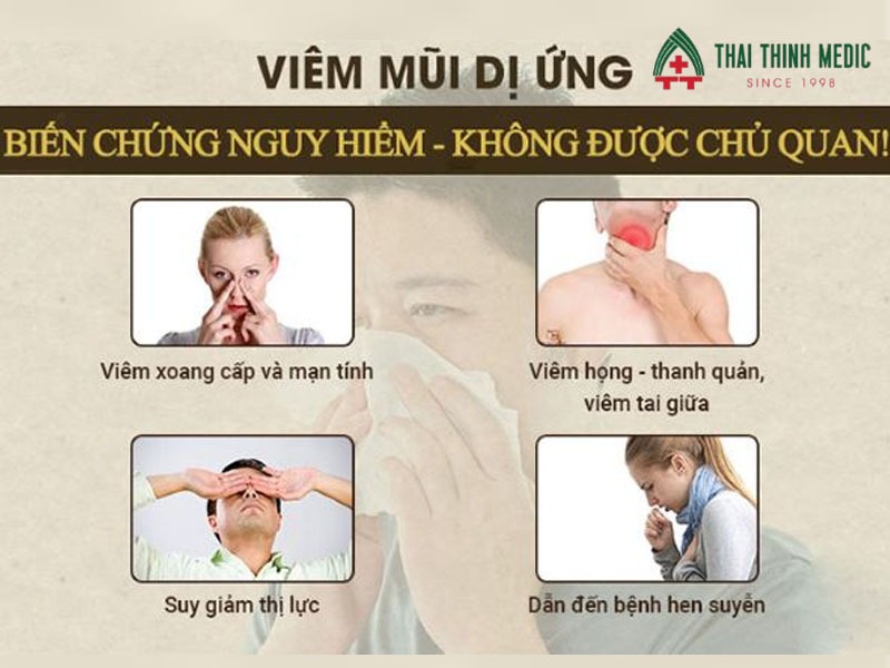 bien-chung-cua-viem-mui-di-ung