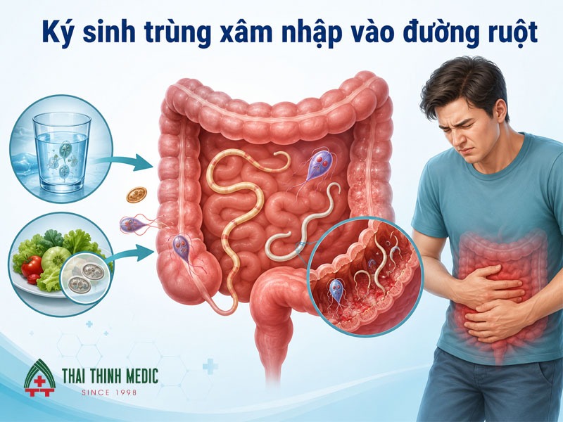 ky-sinh-trung-gay-viem-duong-ruot