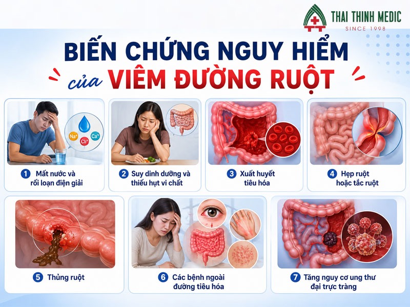 bien-chung-viem-duong-ruot