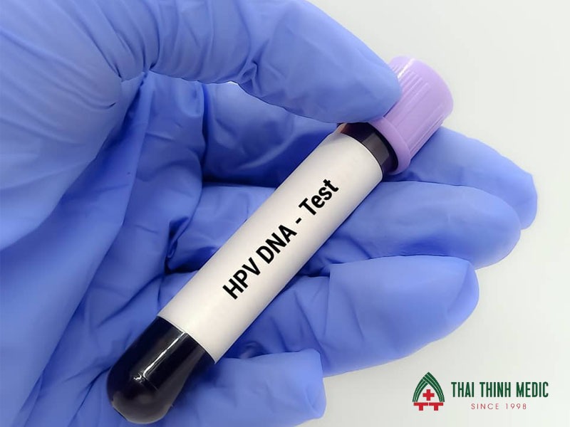 hpv-dna-tam-soat-ung-thu-co-tu-cung
