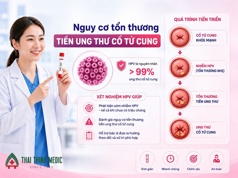 xet-nghiem-hpv-phat-hien-nguy-co-ton-thuong-tien-ung-thu