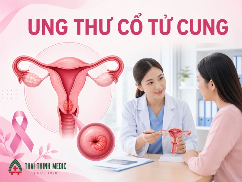 ung-thu-co-tu-cung-co-bieu-hien-gi