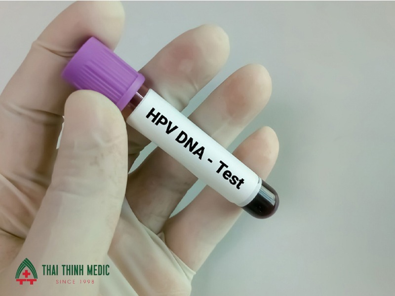 chi-phi-tam-soat-ung-thu-co-tu-cung -hpv
