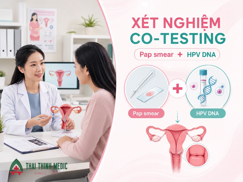 chi-phi-tam-soat-ung-thu-co-tu-cung -co-testing