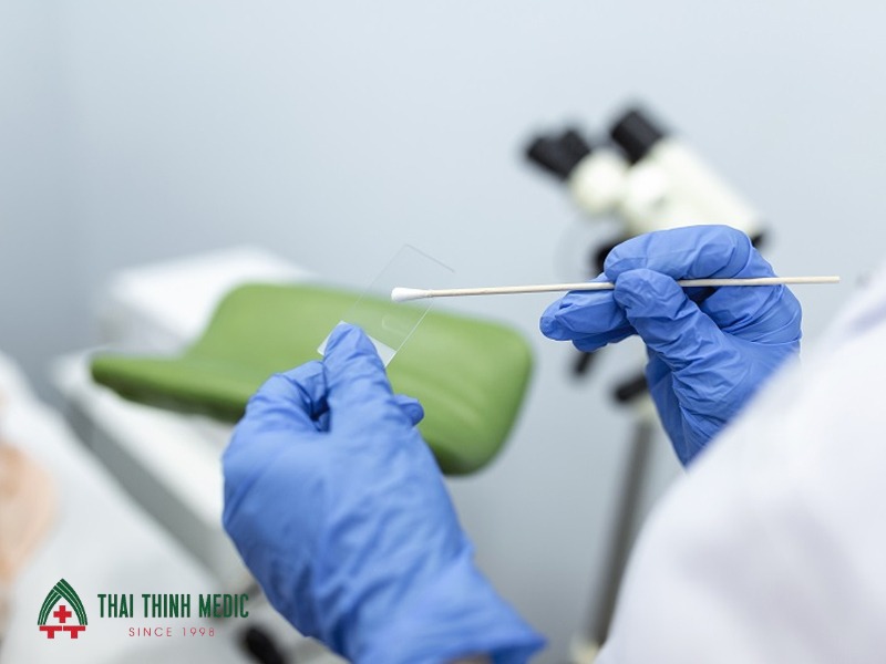 cach-doc-ket-qua-tam-soat-ung-thu-co-tu-cung-pap-smear