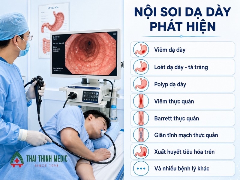 noi-soi-da-day-co-phat-hien-ung-thu-khong-cau-hoi