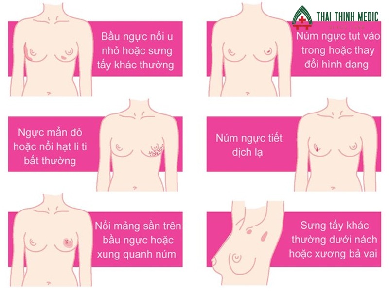 phuong-phap-tam-soat-ung-thu-vu-tu-kham