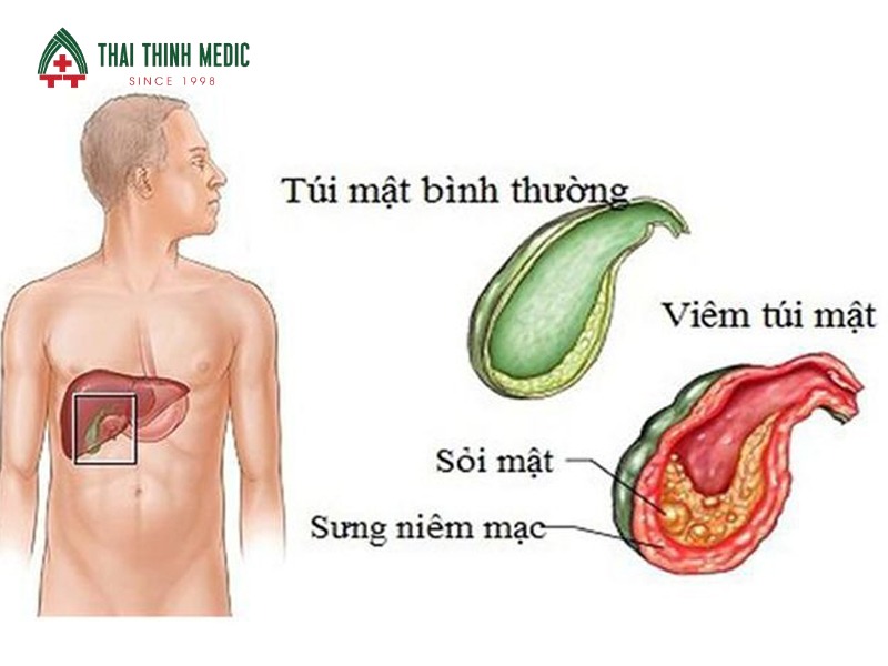 dau-thuong-vi-benh-duong-mat