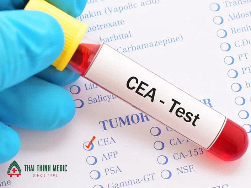 y-nghia-cua-cea-trong-ung-thu-vu-ket-qua