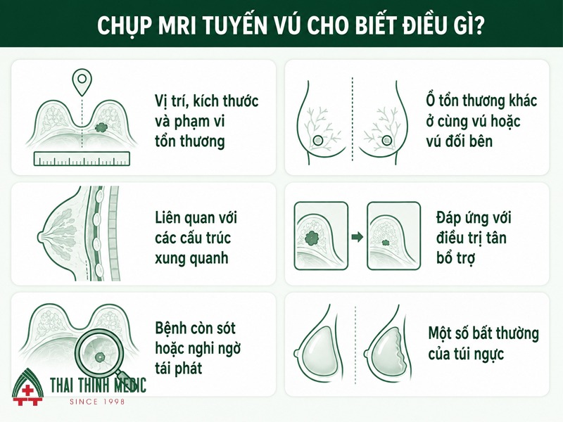 chup-mri-tuyen-vu-cho-biet-dieu-gi
