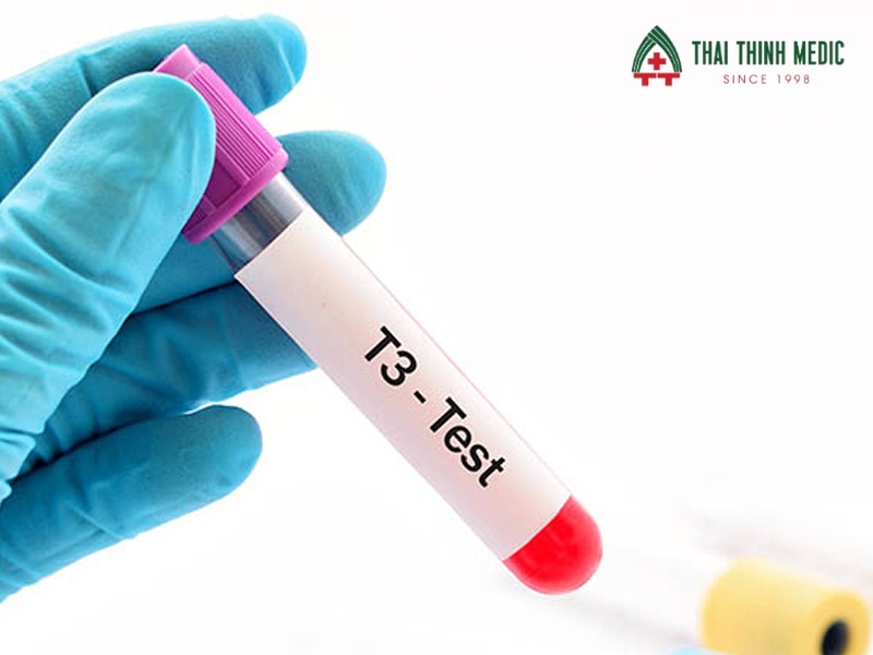 xet-nghiem-tuyen-giap-t3