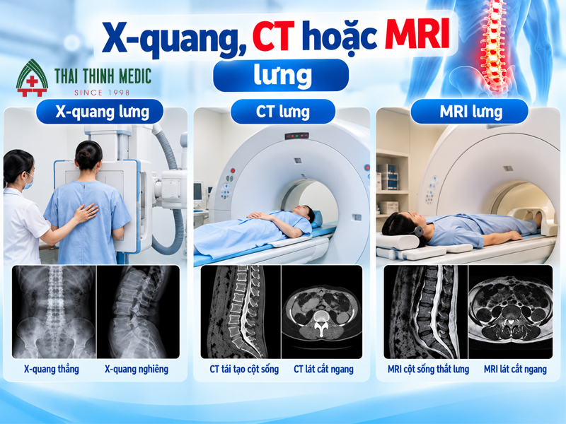 x-quang-dau-lung