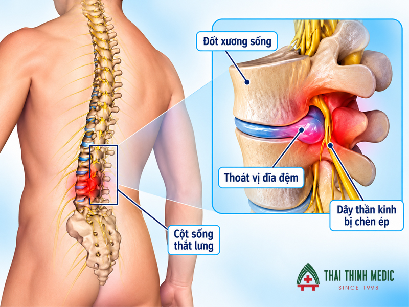 dau-lung-do-re-than-kinh