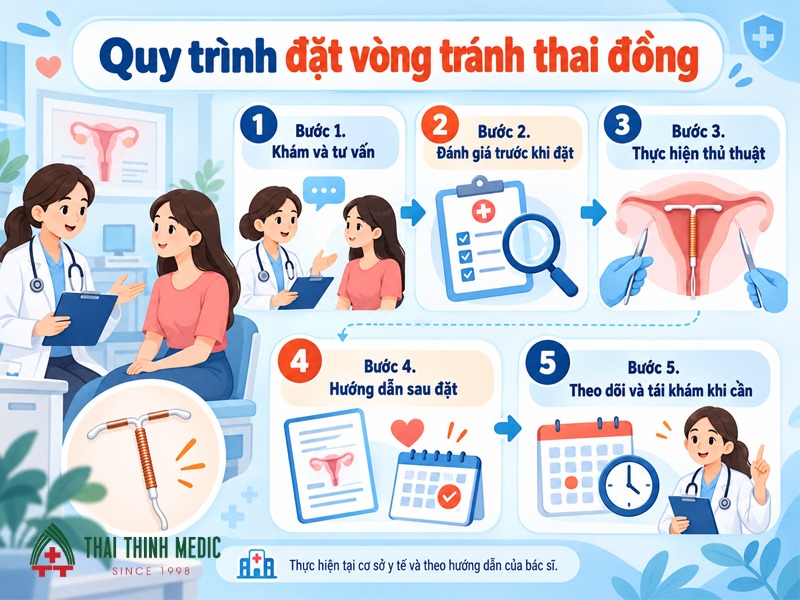 quy-trinh-dat-vong-tranh-thai-dong
