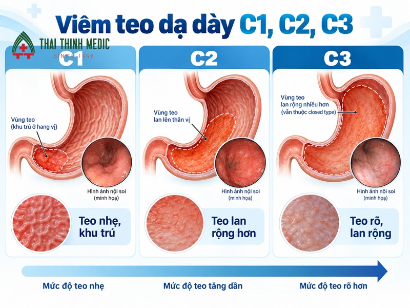 viem-teo-niem-mac-da-day-c1-c2-c3