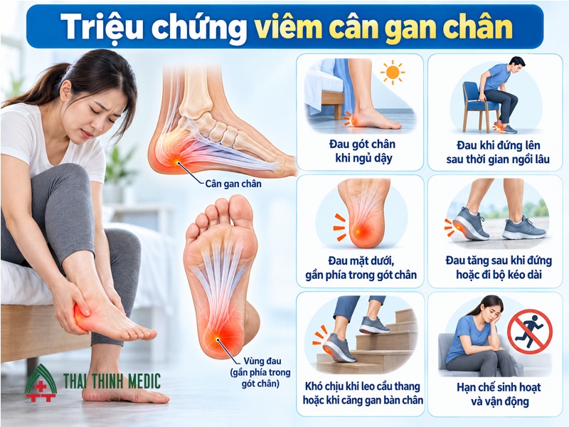 trieu-chung-viem-can-gan-chan