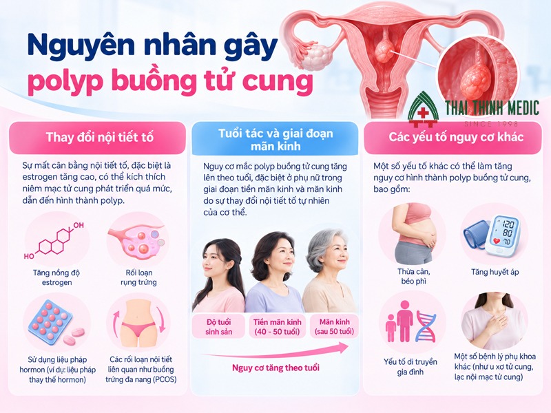 nguyen-nhan-polyp-buong-tu-cung