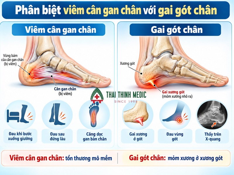 phan-biet-viem-can-gan-chan