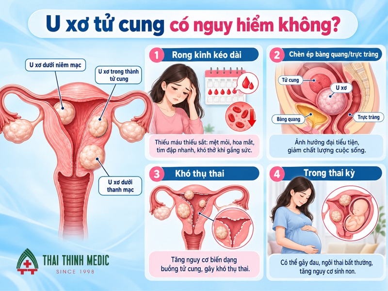 u-xo-tu-cung-co-nguy-hiem-khong