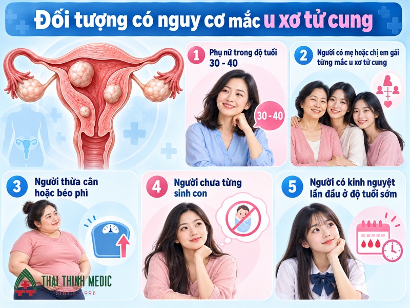 u-xo-tu-cung-doi-tuong