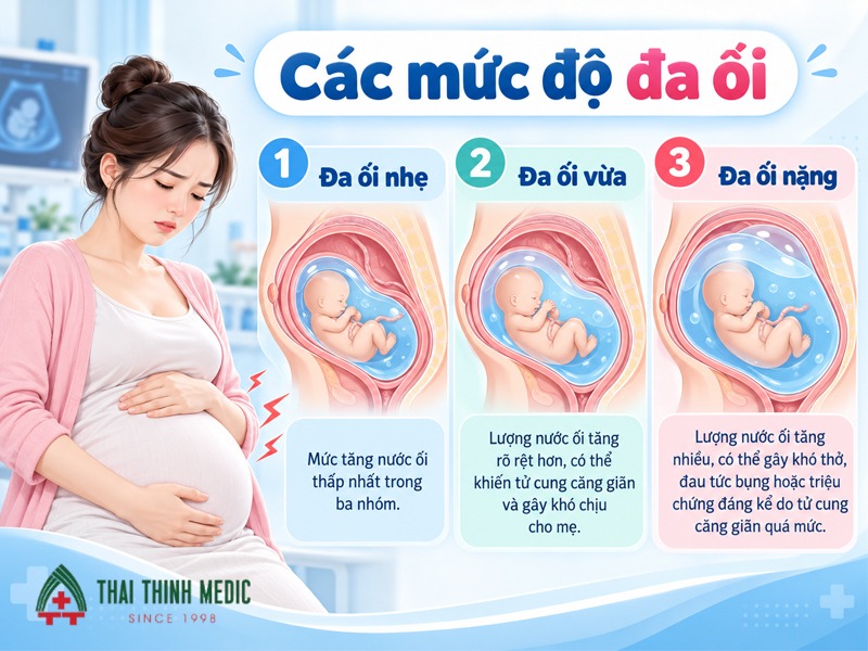 muc-do-doi-oi