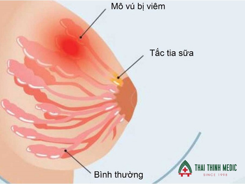 tac-tia-sua