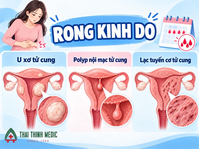 rong-kinh-do-polyp