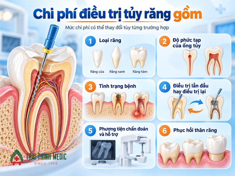 chi-phi-dieu-tri-tuy-rang