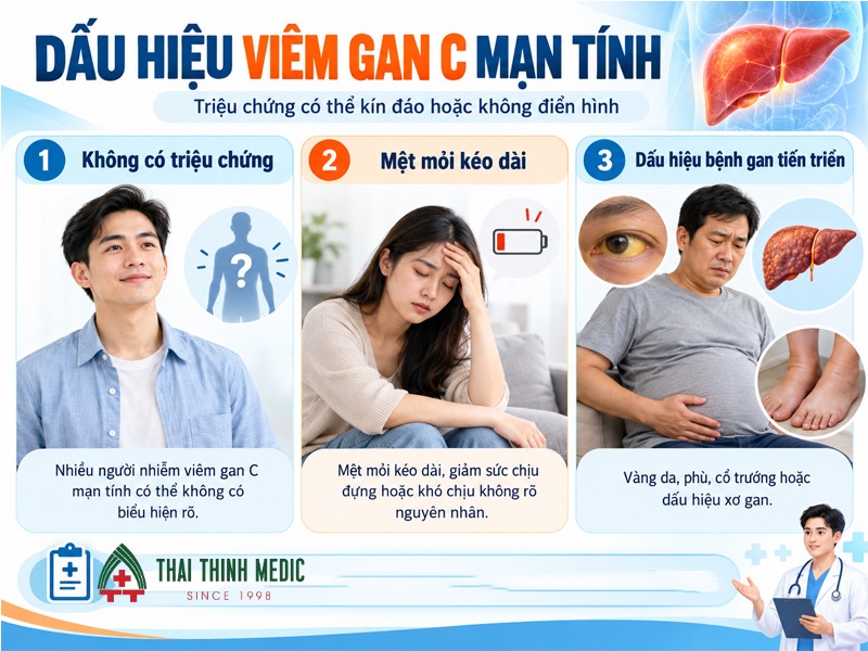 dau-hieu-viem-gan-c