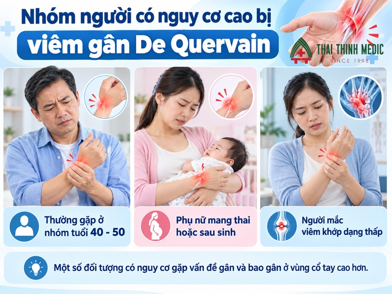 doi-tuong-viem-gan-de-quervain