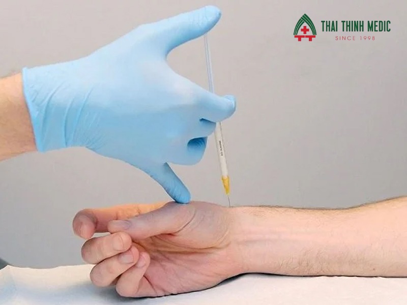 tiem-corticoid-viem-gan-de-quervain