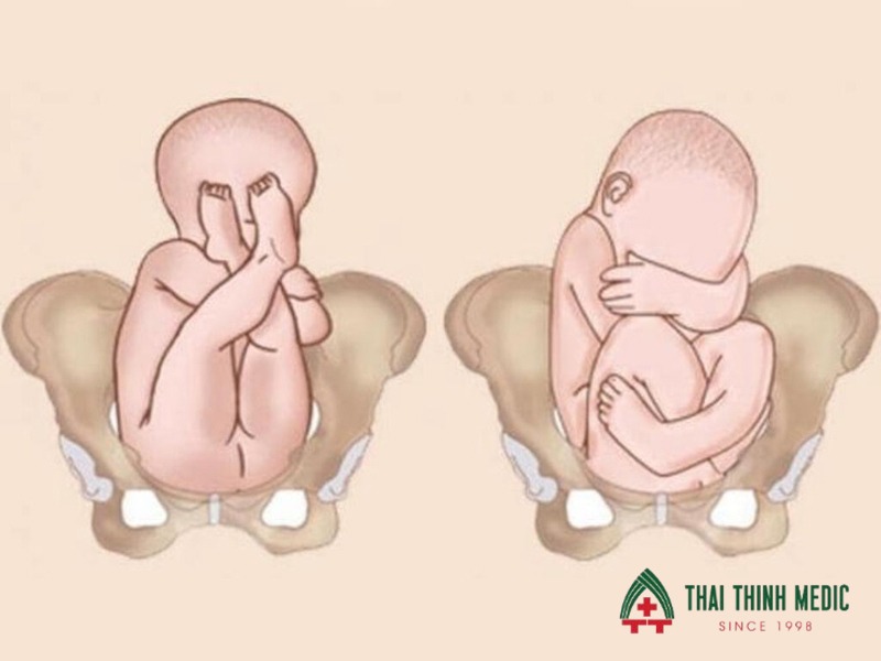ngoi-thai-nguoc-33-35-tuan