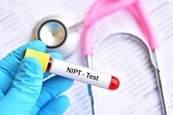 xet-nghiem-nipt
